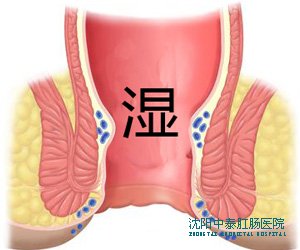 肛门潮湿